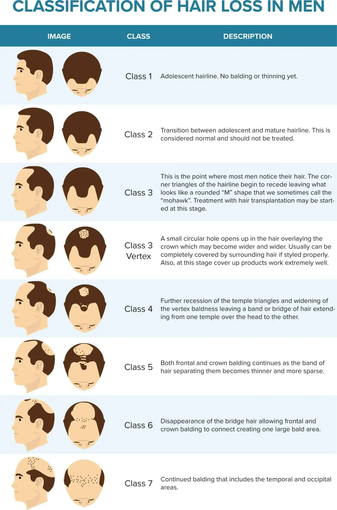 Classification of hair loss in men
