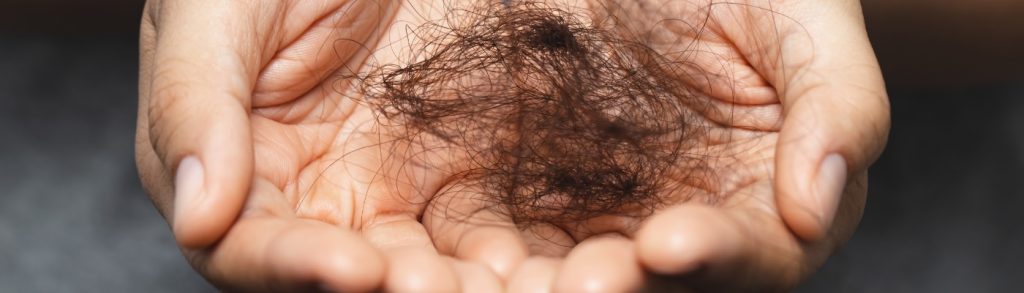 Don’t Ignore These Warning Signs! When to Consider Professional Help for Hair Loss Treatment Don’t Ignore These Warning Signs! When to Consider Professional Help for Hair Loss Treatment